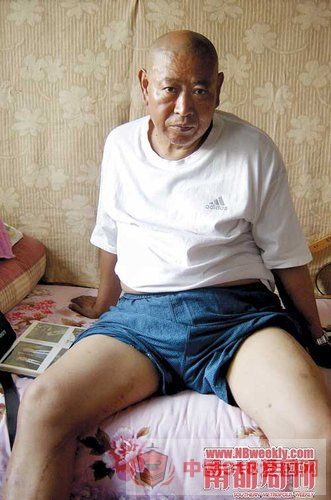日军毒气弹受害者:我的内脏都糜烂了